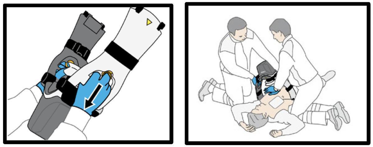 05. Massage cardiaque automatisé 05. Massage cardiaque automatisé