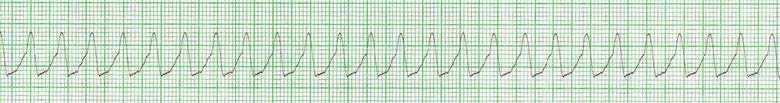 14. Appréciation spécifique : rythmes en arrêt cardiorespiratoire 14. Appréciation spécifique : rythmes en arrêt cardiorespiratoire