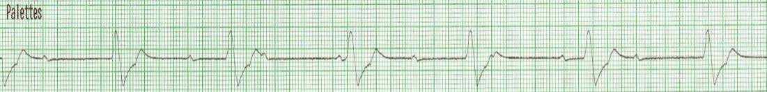 14. Appréciation spécifique : rythmes en arrêt cardiorespiratoire 14. Appréciation spécifique : rythmes en arrêt cardiorespiratoire