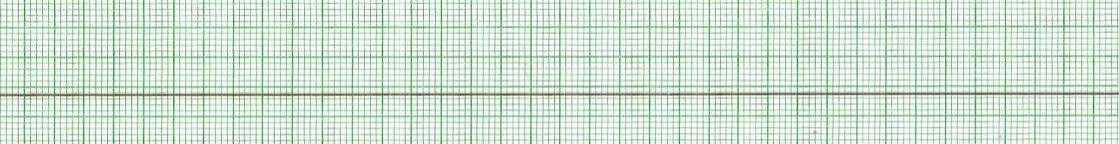 14. Appréciation spécifique : rythmes en arrêt cardiorespiratoire