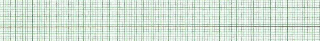 14. Appréciation spécifique : rythmes en arrêt cardiorespiratoire 14. Appréciation spécifique : rythmes en arrêt cardiorespiratoire
