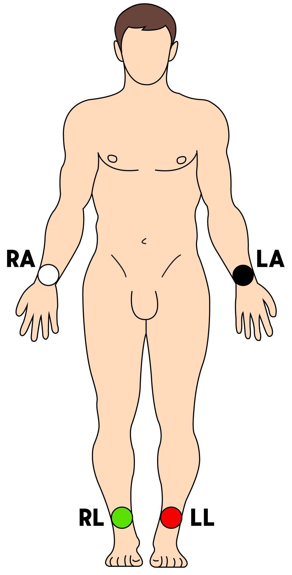 09. Électrocardiogramme (ECG) en 12 dérivations (12D)