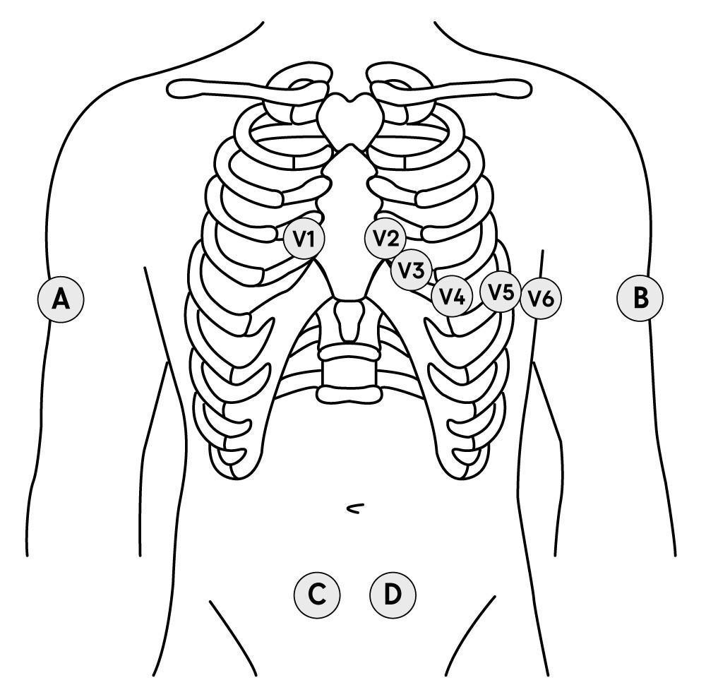 09. Électrocardiogramme (ECG) en 12 dérivations (12D)