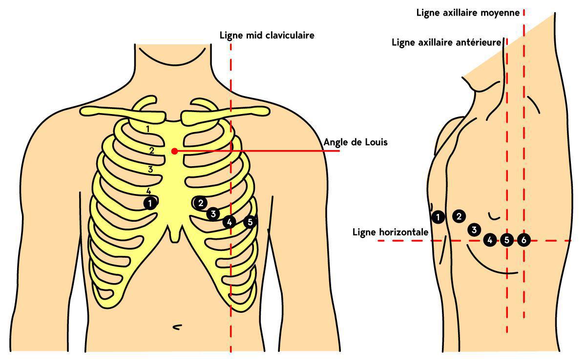09. Électrocardiogramme (ECG) en 12 dérivations (12D) 09. Électrocardiogramme (ECG) en 12 dérivations (12D)