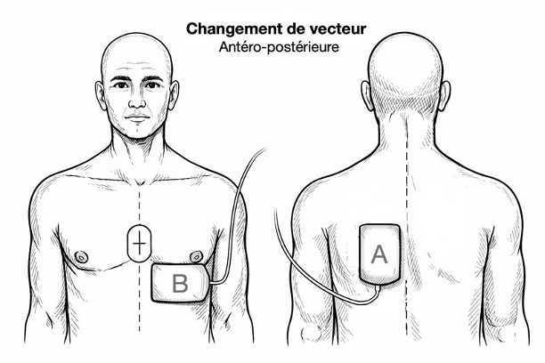 Principes généraux de réanimation Principes généraux de réanimation