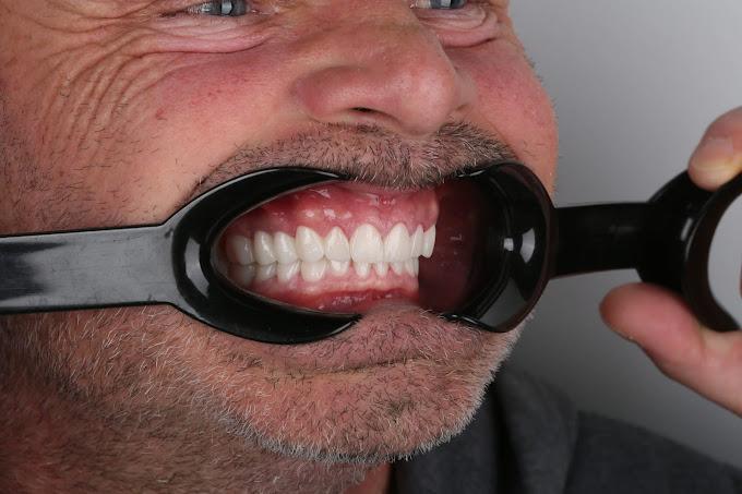 DENTFIX DENTAL CLINIC IN ISTANBUL TURKEY DENTFIX DENTAL CLINIC IN ISTANBUL TURKEY