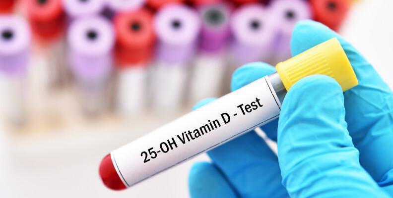 Test Vitamina D
