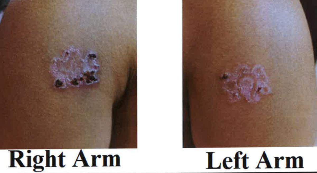 Temple in Texas Sued for $1 Million for Branding 11-year-old Temple in Texas Sued for $1 Million for Branding 11-year-old