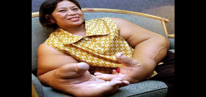 Découvrez la femme aux plus grosses mains du monde (vidéo)