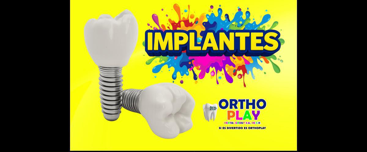 IMPLANTES