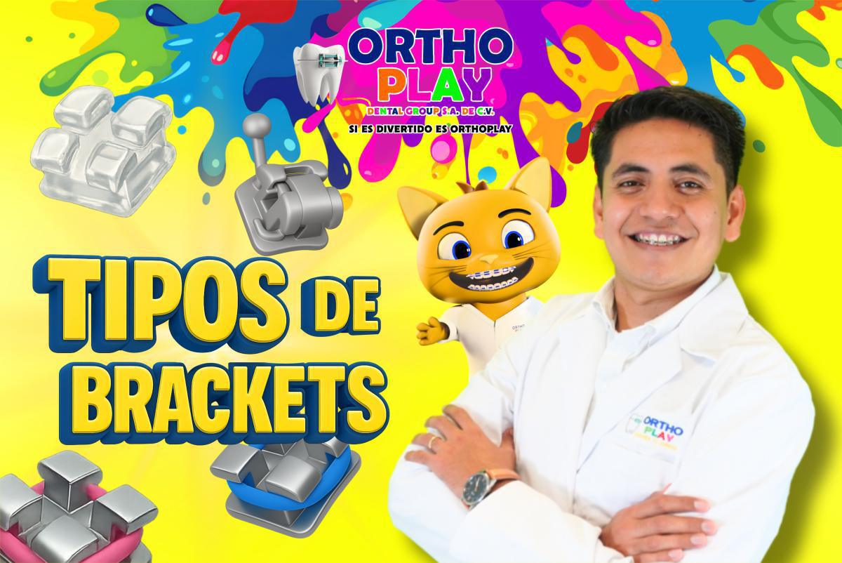 TIPOS DE BRACKETS TIPOS DE BRACKETS