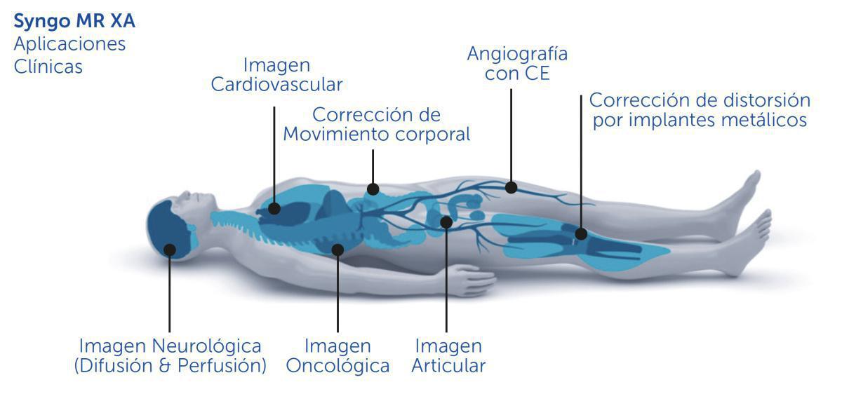 NUEVA Resonancia Magnética de última generación / MAGNETOM SOLA