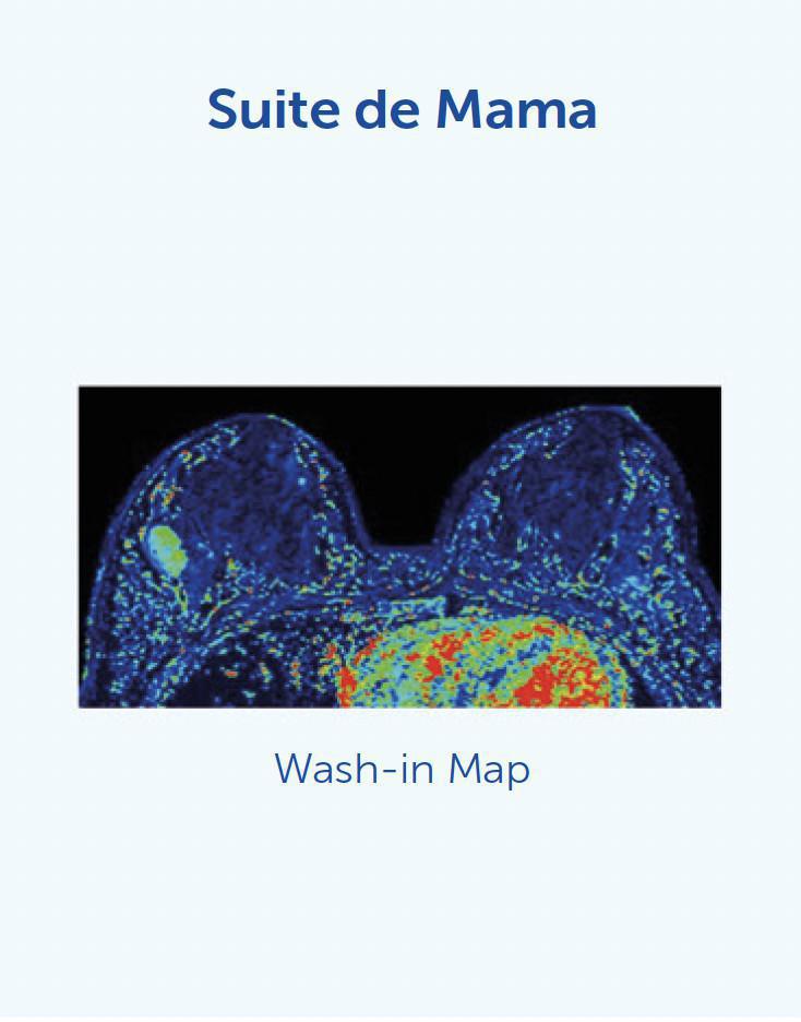 NUEVA Resonancia Magnética de última generación / MAGNETOM SOLA