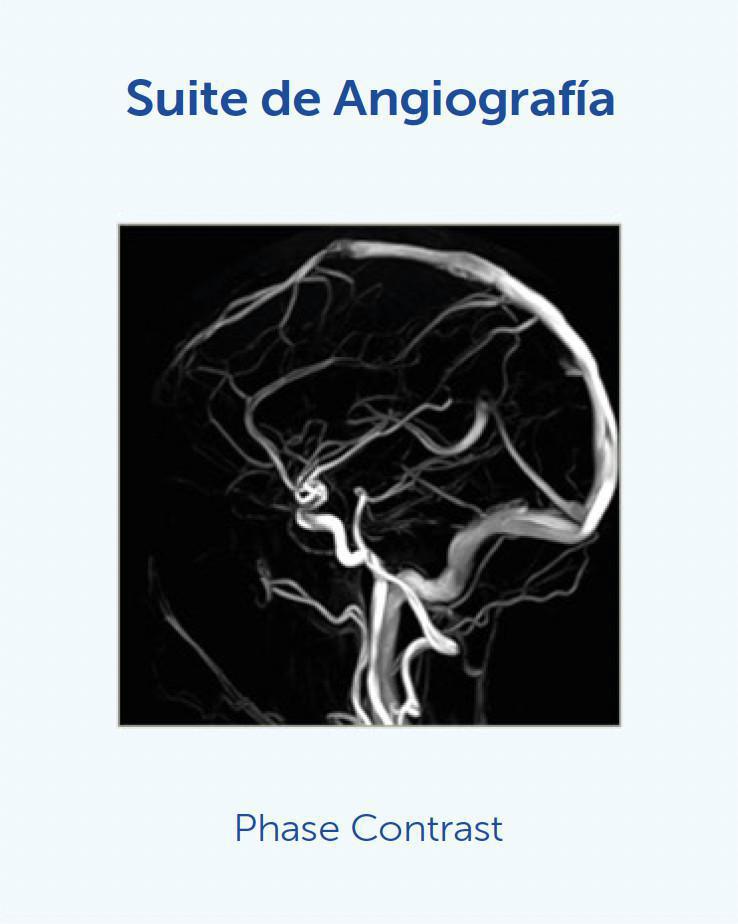 NUEVA Resonancia Magnética de última generación / MAGNETOM SOLA