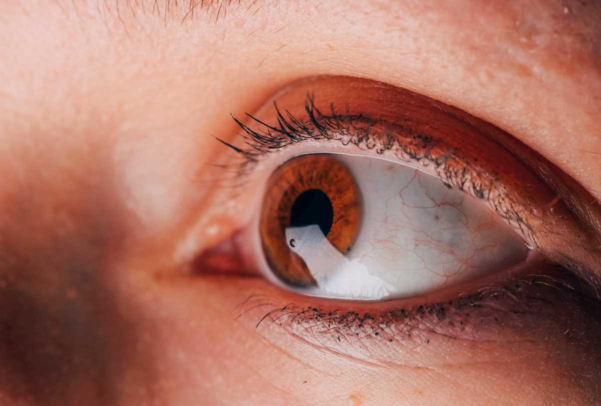 3 Junio | Conferencias: Innovaciones de Oculoplástica y Cuando la piedra no es en el zapato (caso de trauma ocular).