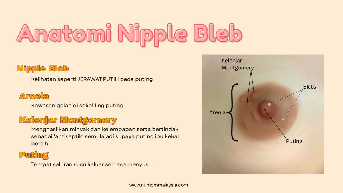 JERAWAT PUTIH PADA PUTING