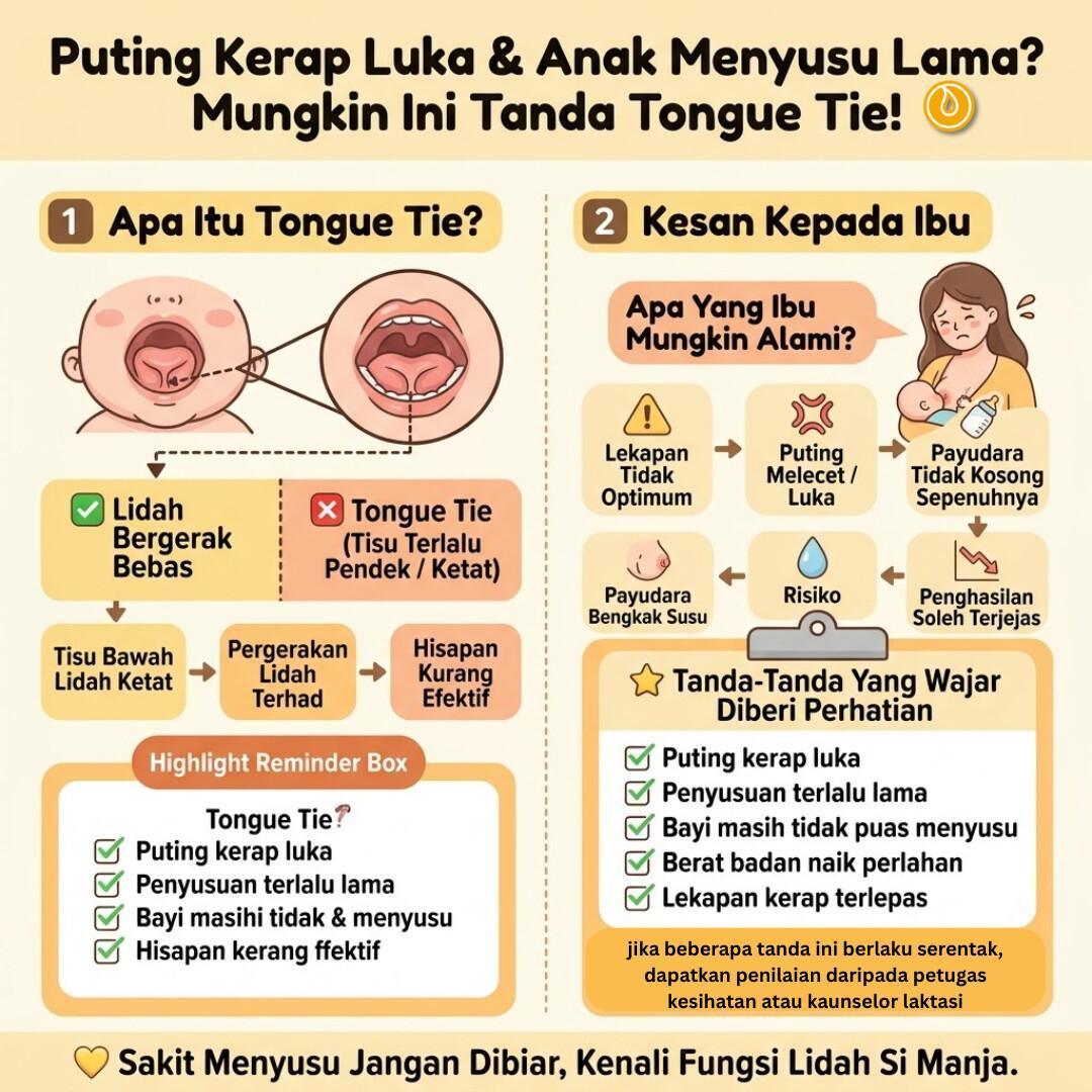 APA ITU TONGUE TIE ?