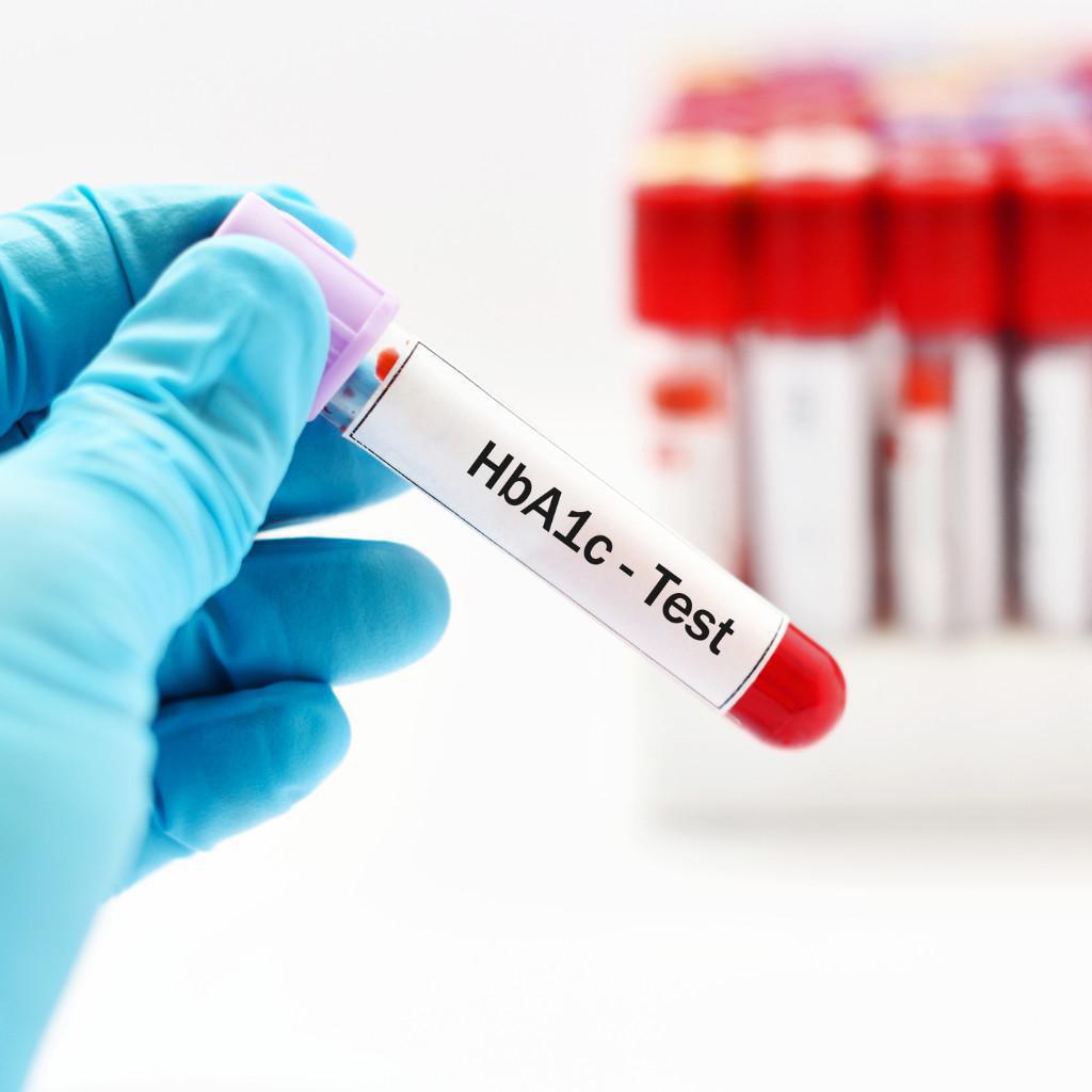 Test dell'emoglobina glicata Test dell'emoglobina glicata