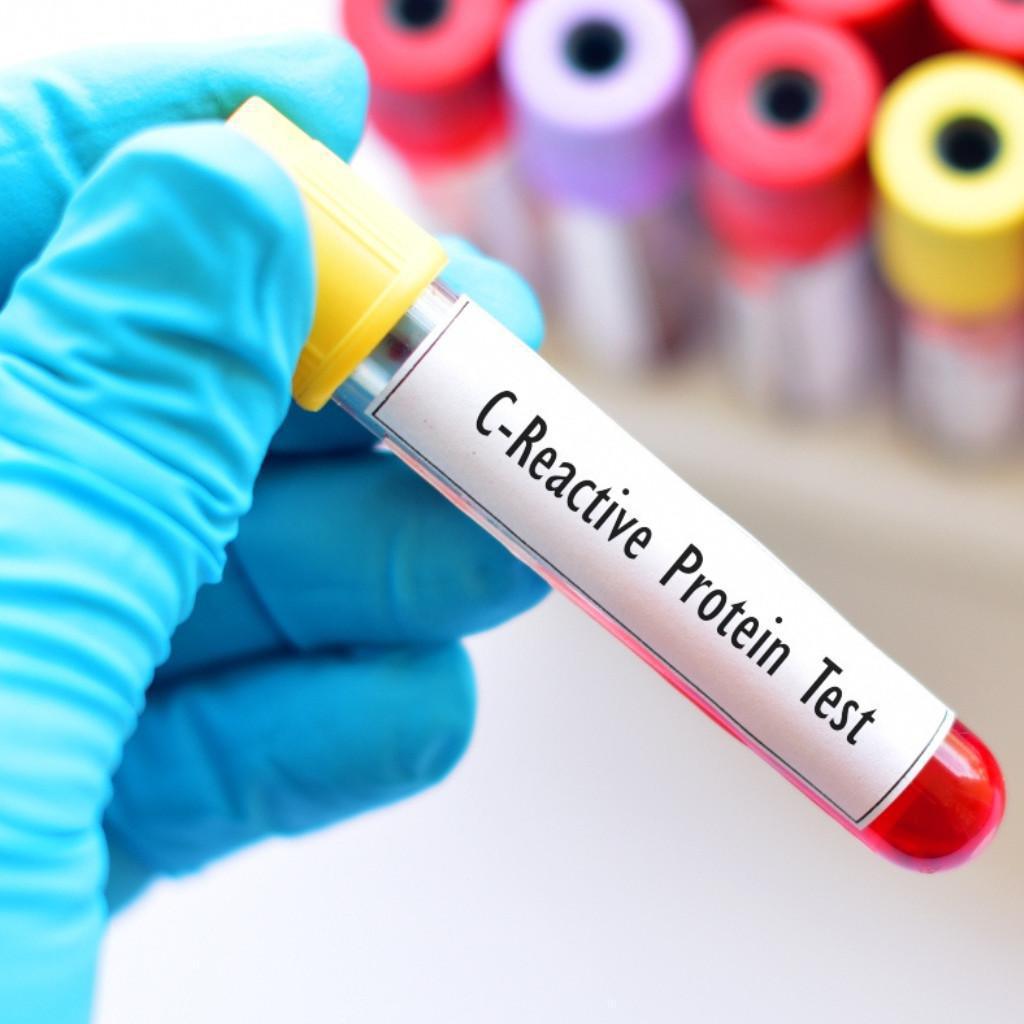 Misurazione PCR (Proteina C Reattiva) Misurazione PCR (Proteina C Reattiva)