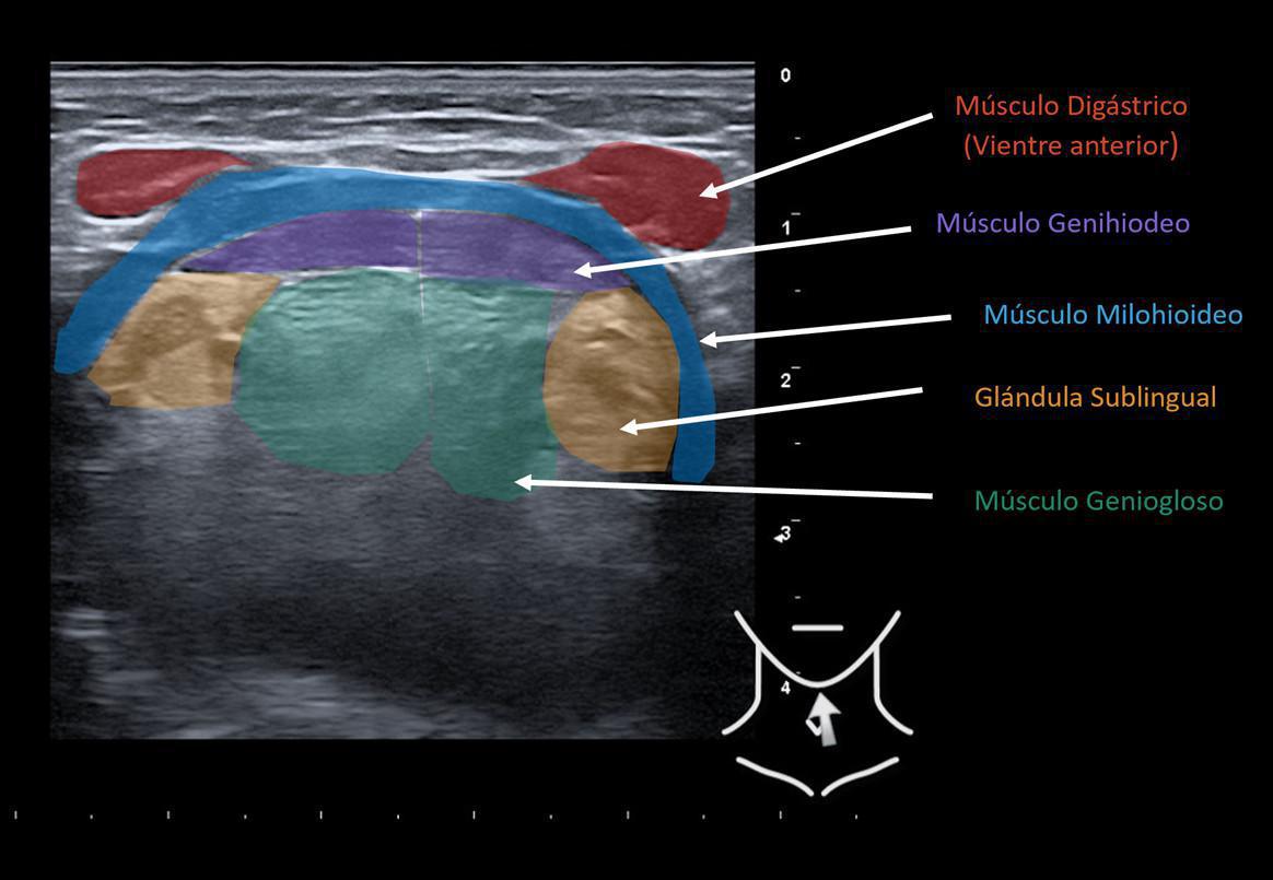 Áreas cervicales ecográficas