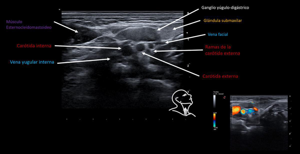 Áreas cervicales ecográficas