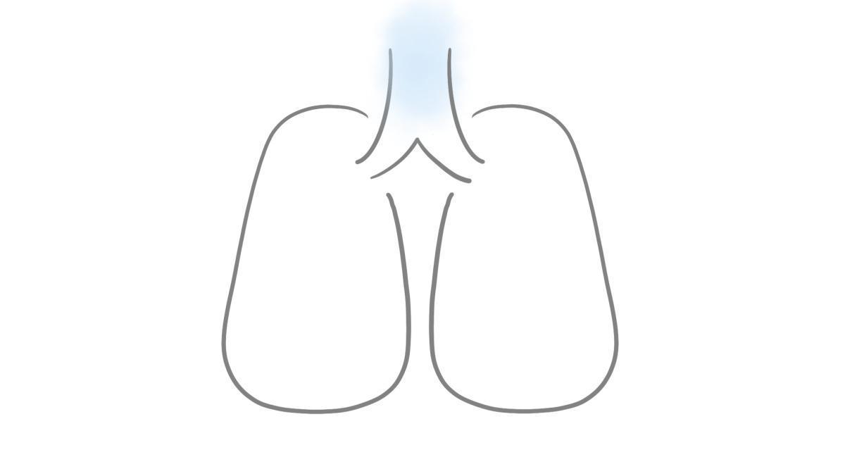 2.9.1.3 Pseudokrupp und Epiglottitis 2.9.1.3 Pseudokrupp und Epiglottitis