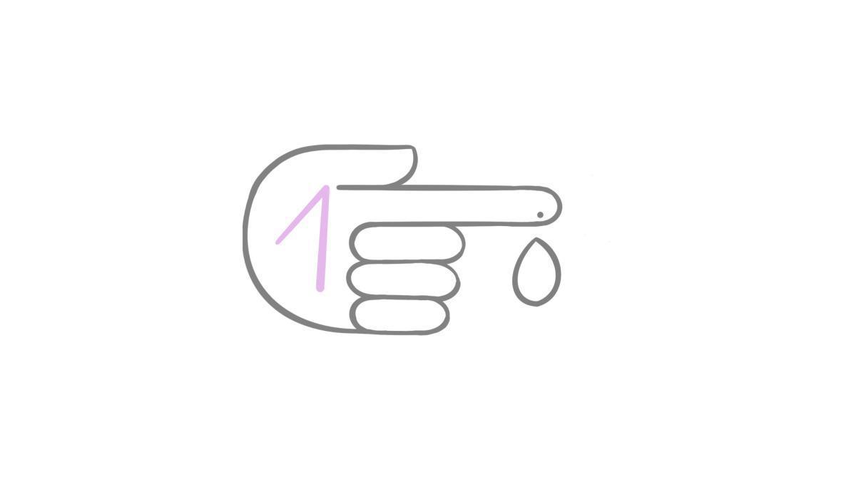8.7.1.2 Typ-1-Diabetes