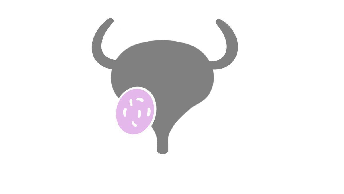 8.5.1 Harnwegsinfektionen (HWI) 8.5.1 Harnwegsinfektionen (HWI)