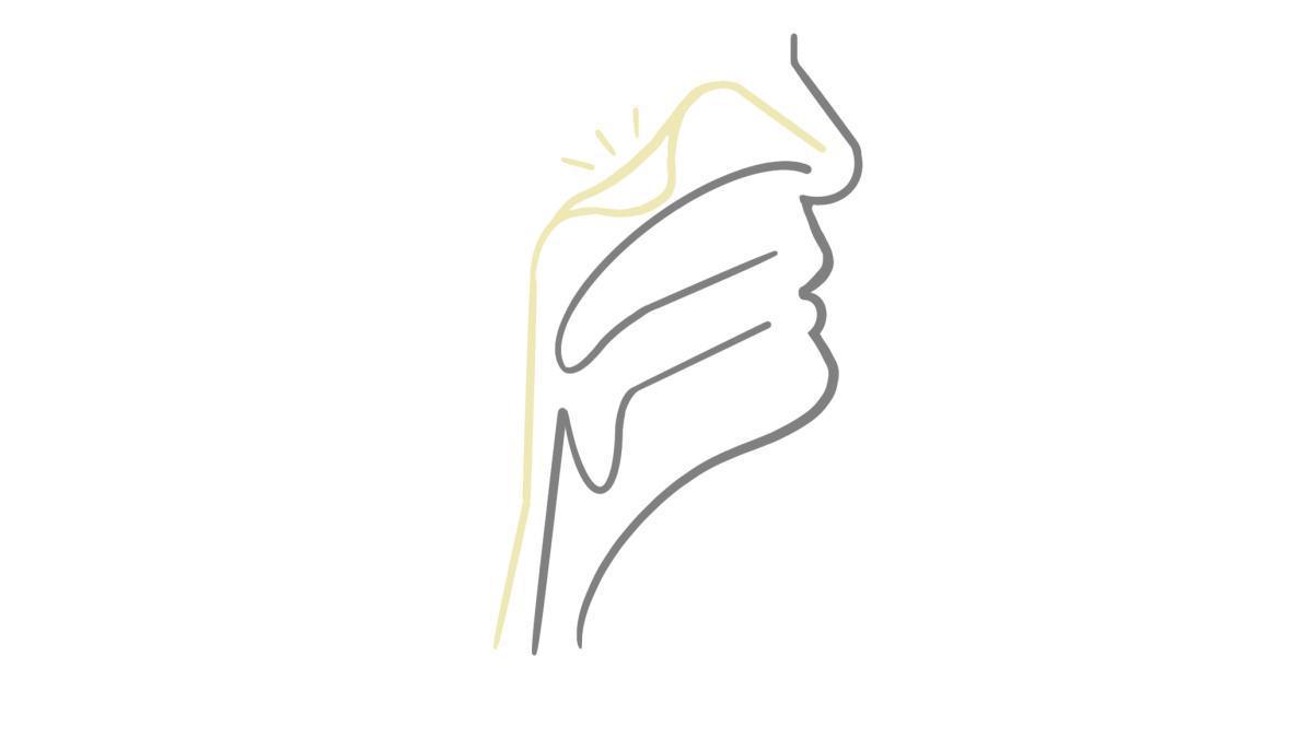 8.3.2 Schnarchen und Polypen 8.3.2 Schnarchen und Polypen