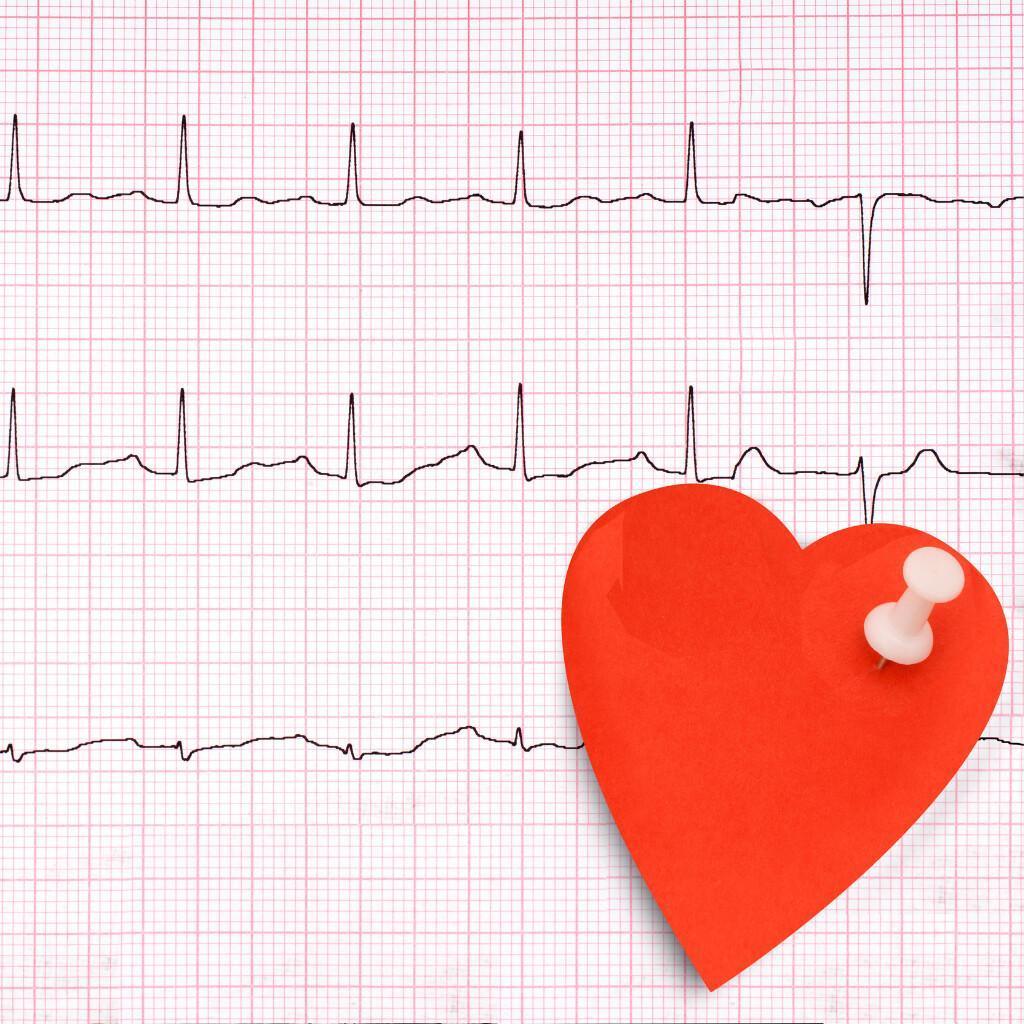 Elettrocardiogramma (ECG) in farmacia: controlla la salute del tuo cuore in modo semplice e veloce