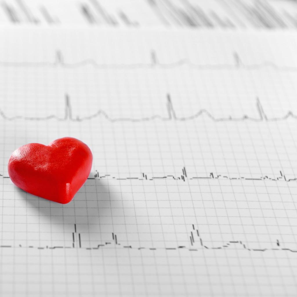 ECG - Elettrocardiogramma ECG - Elettrocardiogramma