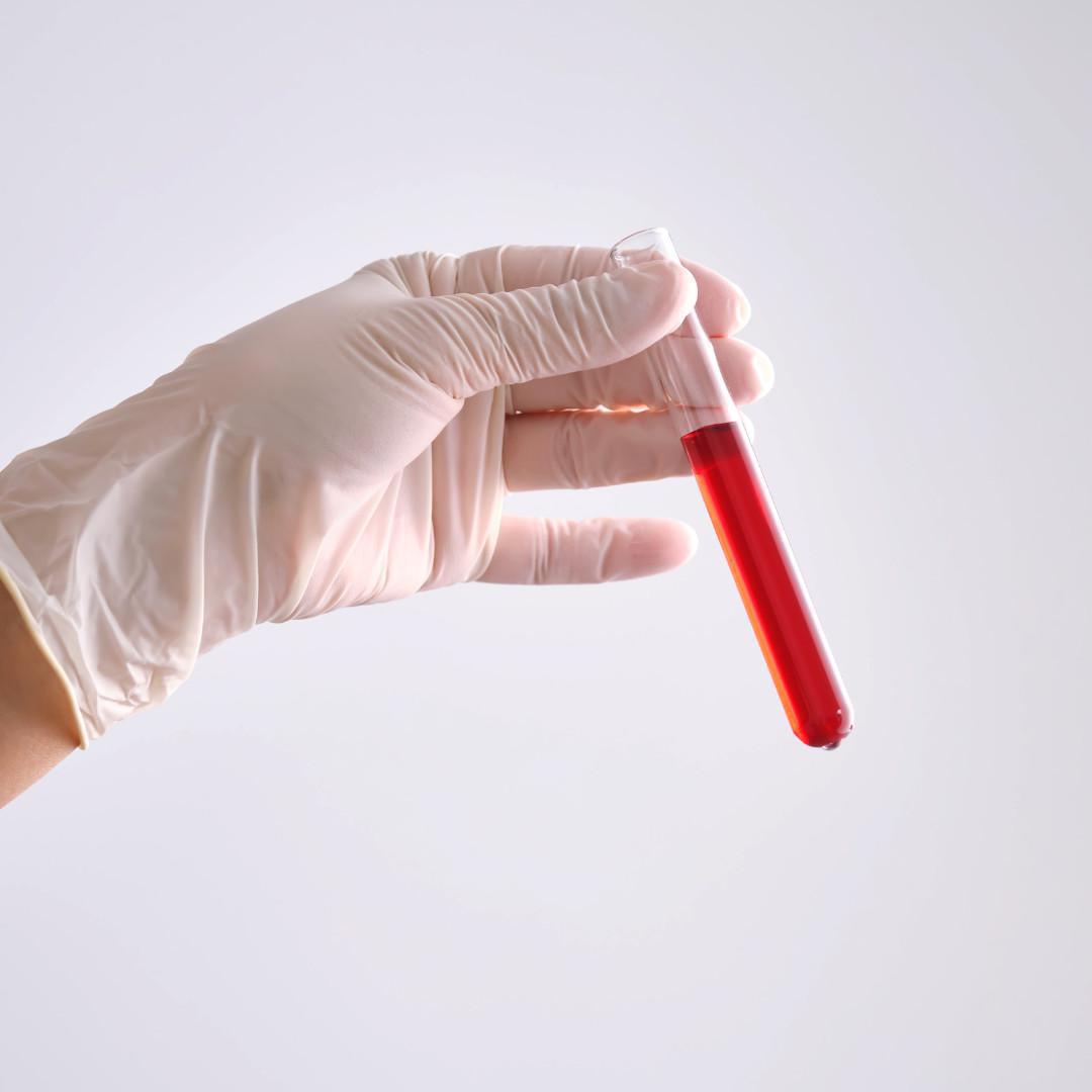 Esami tramite analizzatore Biochimico
