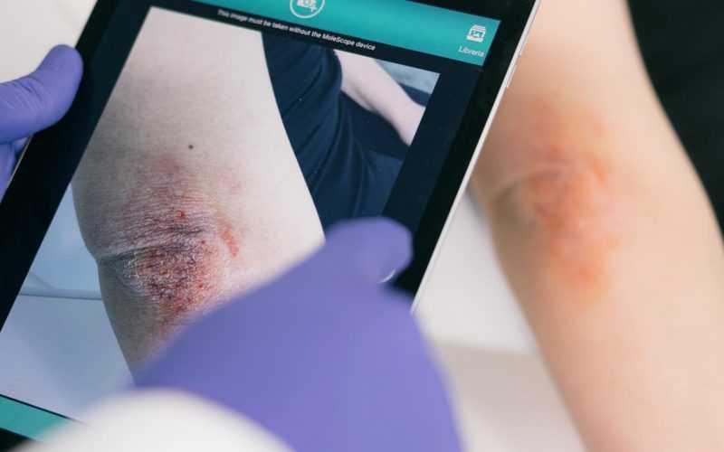 Teledermatologia a Delia: controlla la salute della tua pelle in farmacia