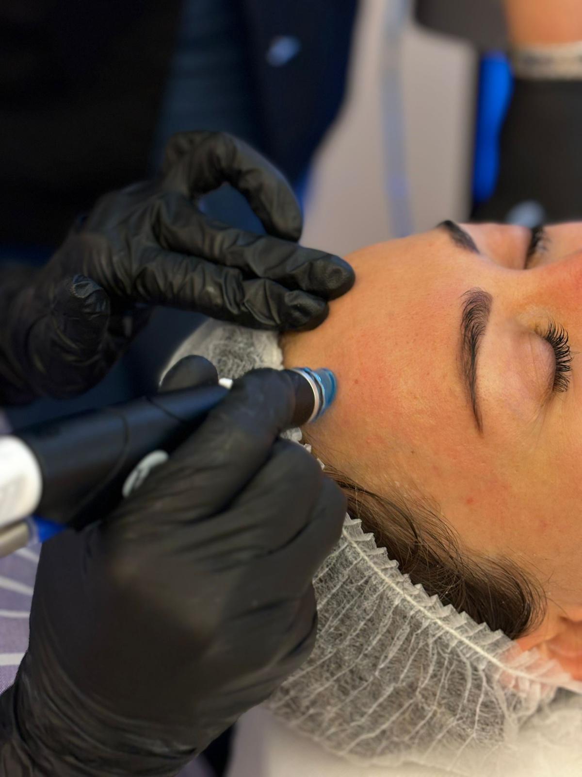 Hydrafacial