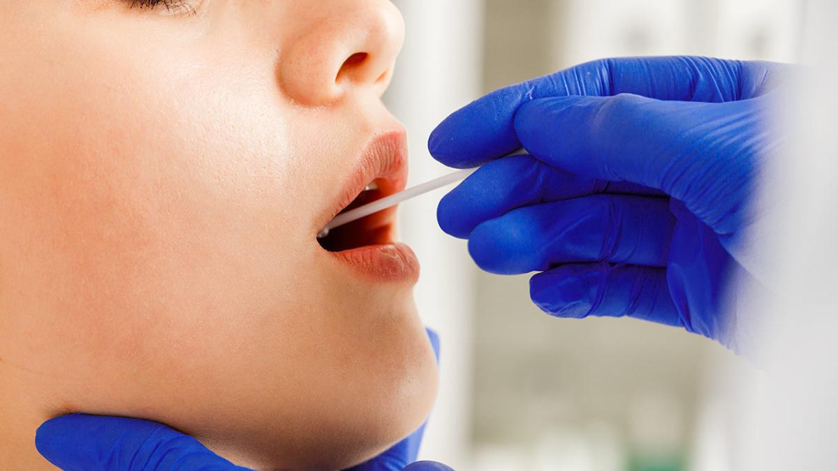 Tampone Streptococco