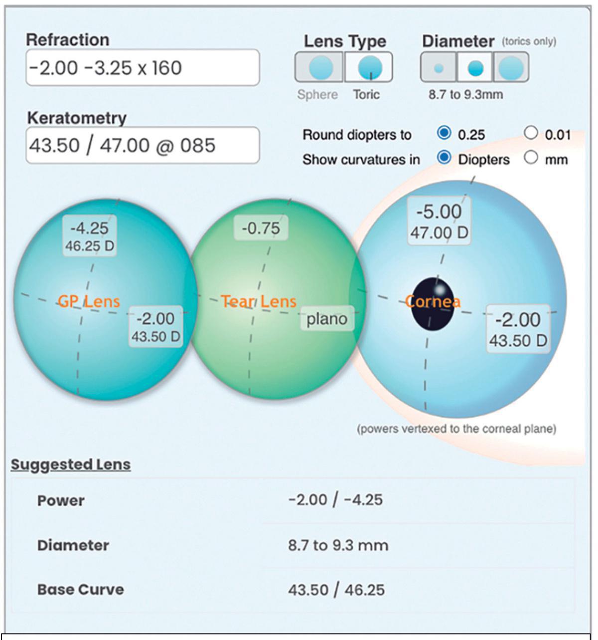 Adaptación empírica de lentes GP (Primera parte) Adaptación empírica de lentes GP (Primera parte)