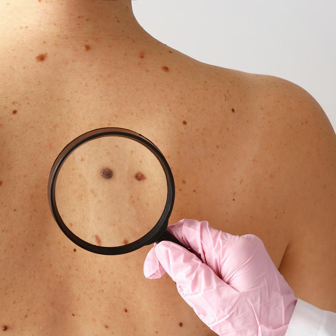 Teledermatologia Teledermatologia