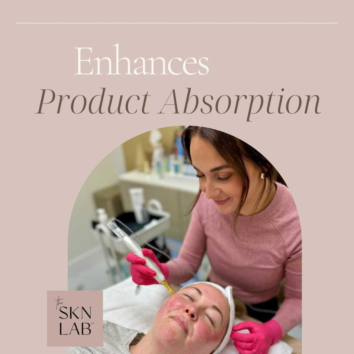 Benefits of Microneedling Benefits of Microneedling