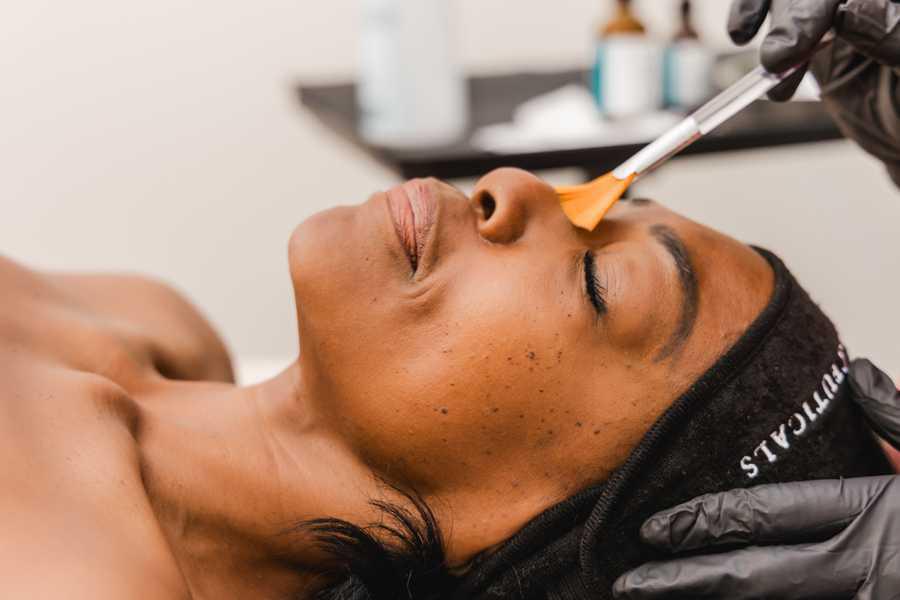 Chemical Peels vs. Lasers: Which One Does Your Skin Actually Need?