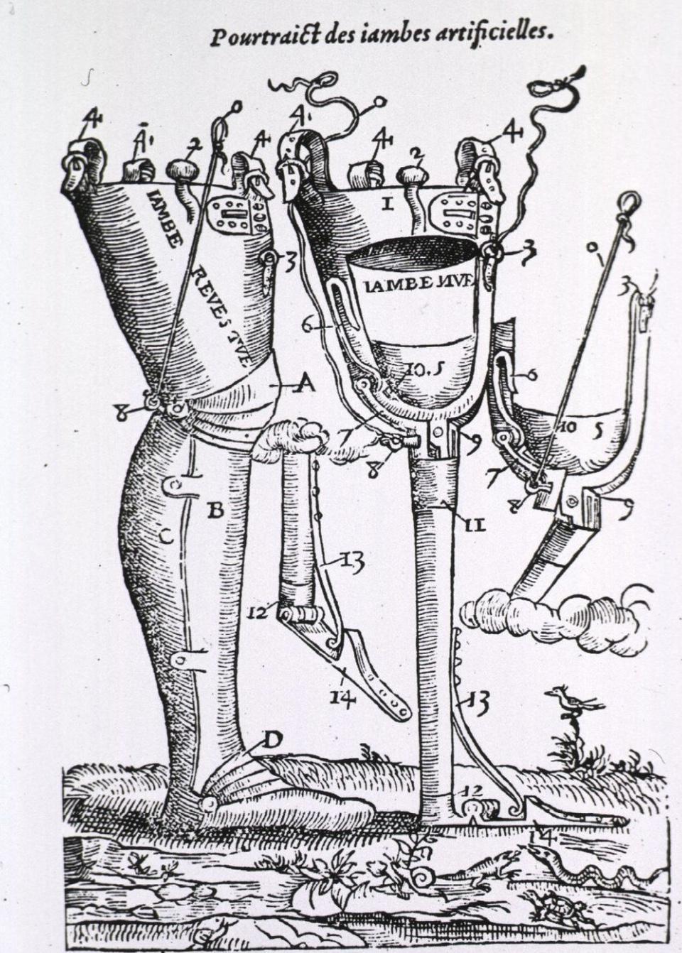 Ambroise Paré : Pionnier de la chirurgie moderne Ambroise Paré : Pionnier de la chirurgie moderne