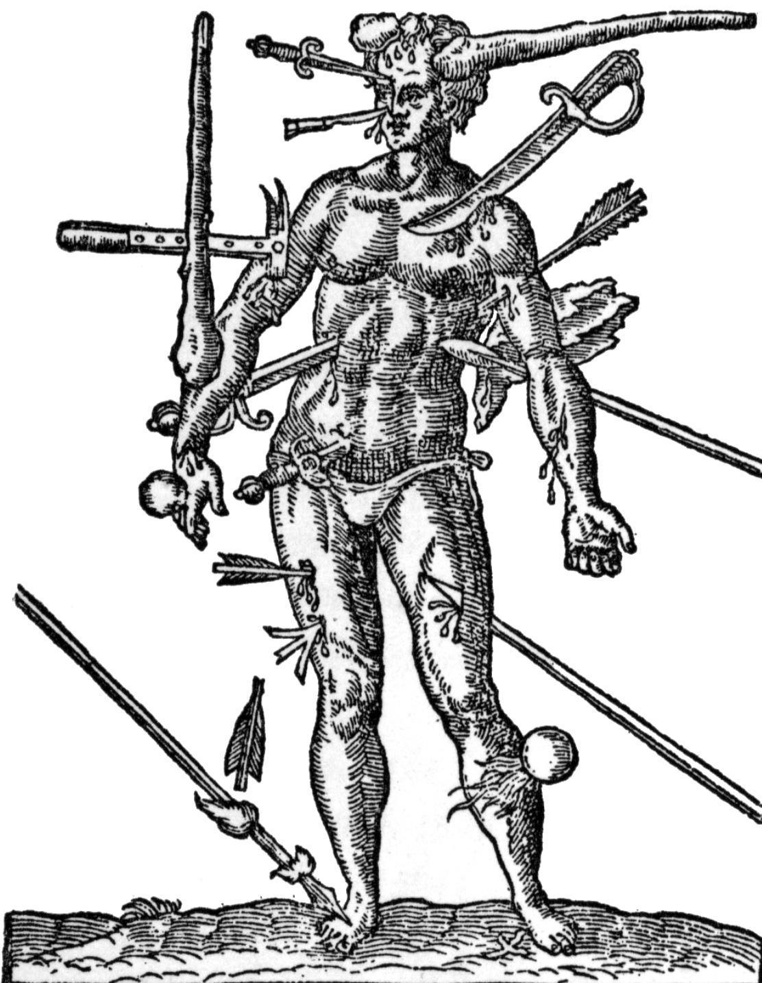 Ambroise Paré : Pionnier de la chirurgie moderne Ambroise Paré : Pionnier de la chirurgie moderne