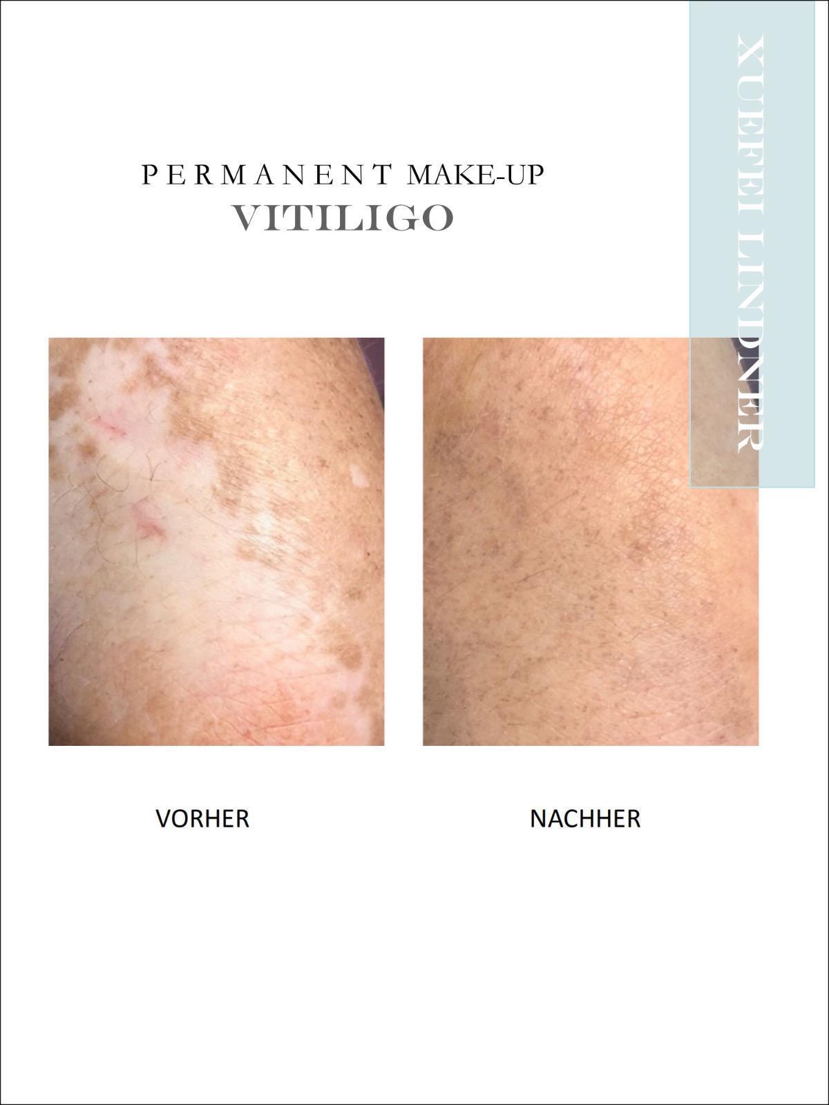 3D-Rekonstruktion - WIE NEU 3D-Rekonstruktion - WIE NEU