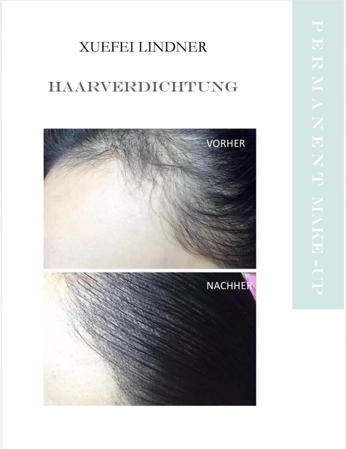 Haaransatzverdichtung