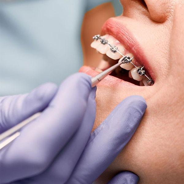 General Dental