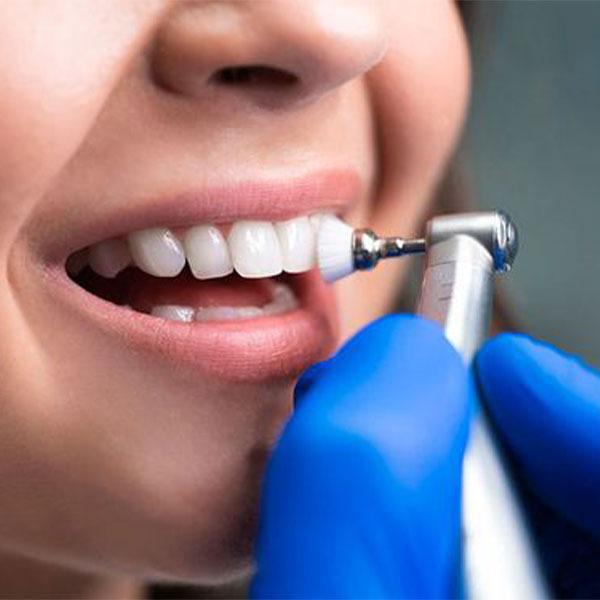 Orthodontic Treatment