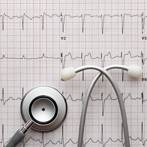 Elettrocardiogramma Elettrocardiogramma