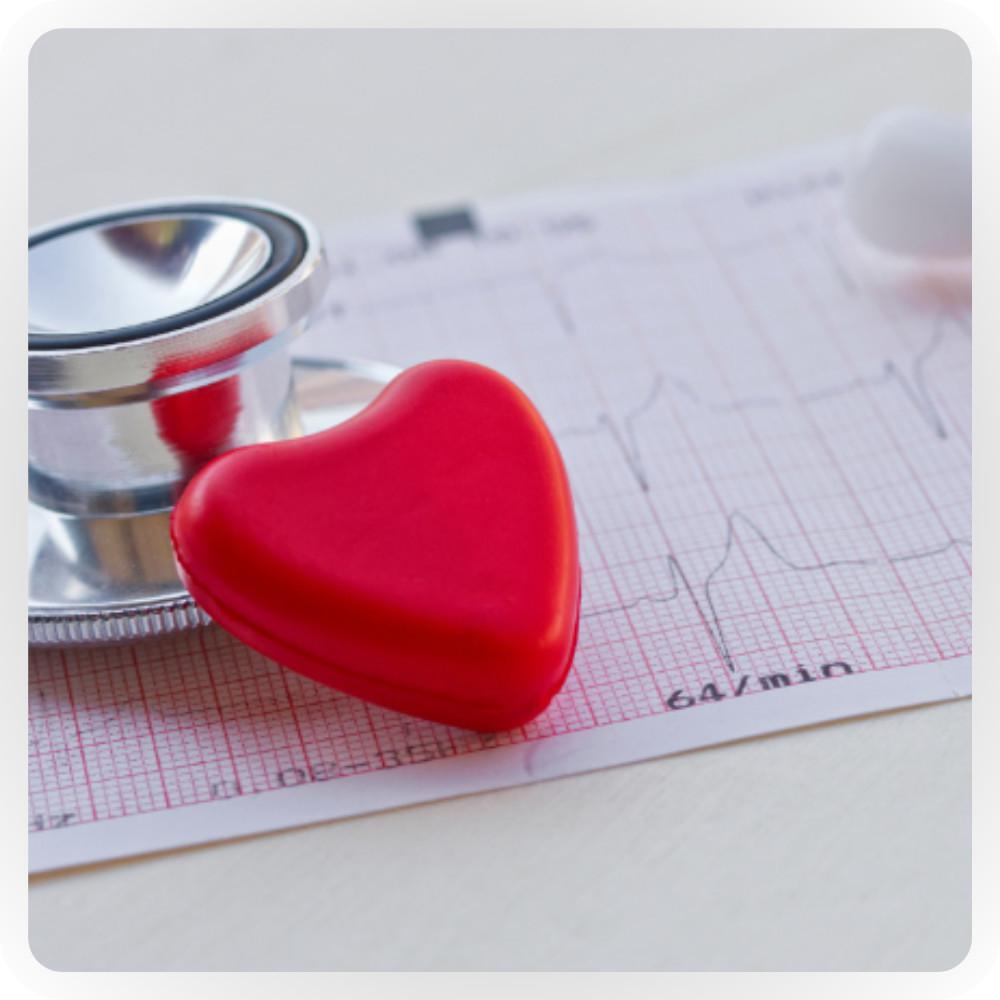 Elettrocardiogramma (ECG)