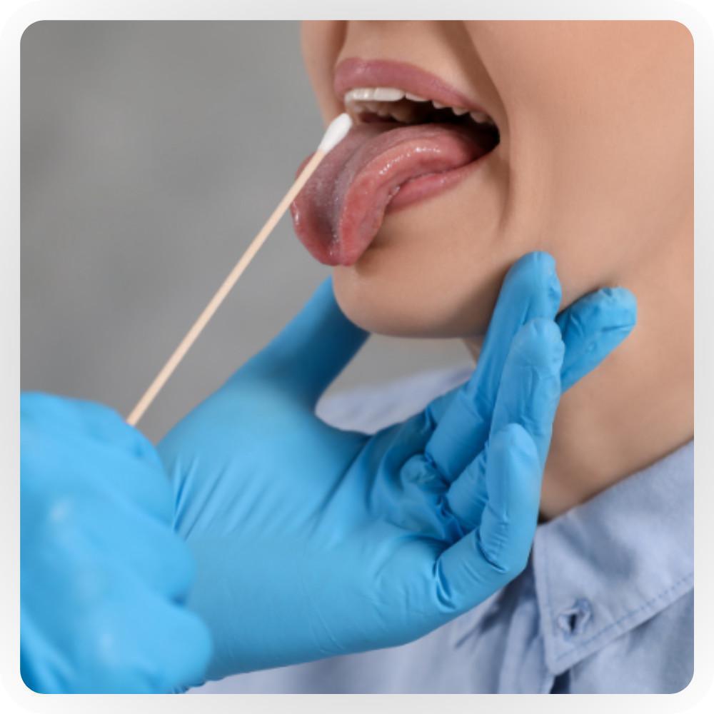 Tampone streptococco Tampone streptococco