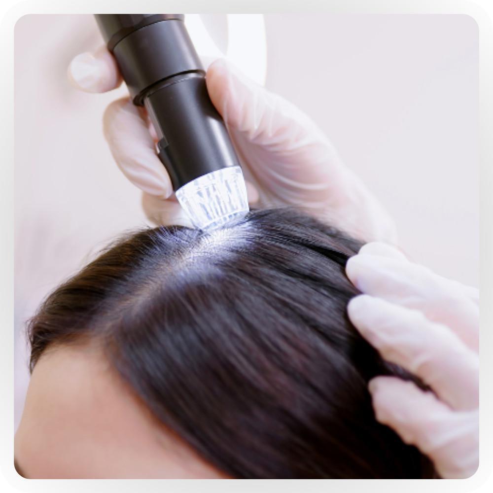 Analisi del cuoio capelluto Analisi del cuoio capelluto