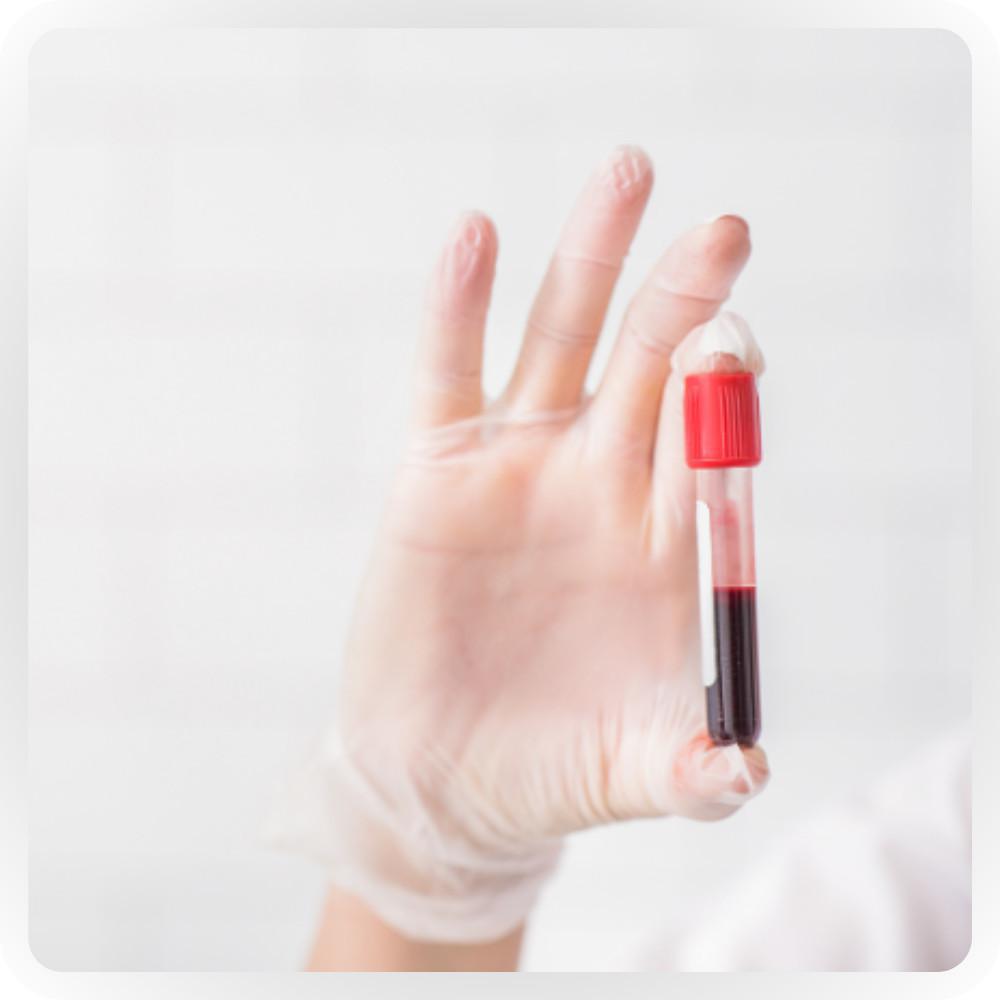 Analisi valori ematici Analisi valori ematici